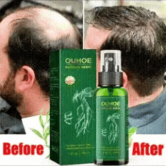 Detén la caída y recupera tu cabello con OUHOE Tonico Capilar🌿